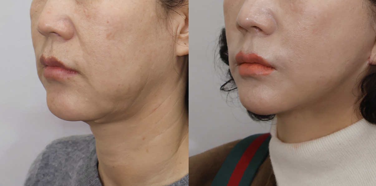 Newline Clinic — recent post 3