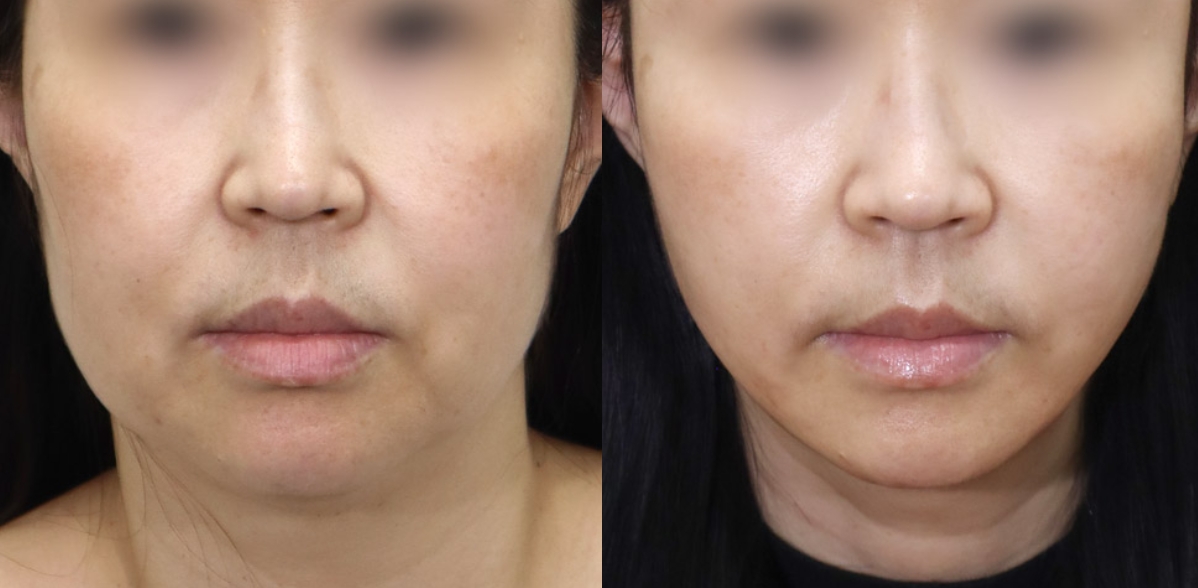Newline Clinic — recent post 6